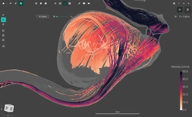 FlowLens screenshot 3