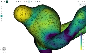 FlowLens screenshot 6