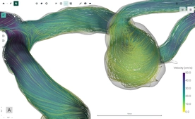 FlowLens screenshot 11