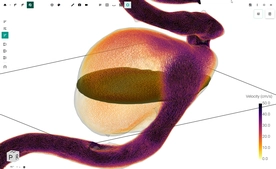 FlowLens screenshot 12