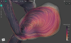 FlowLens screenshot 17
